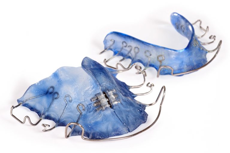 Blaue Dehnplatte, Zahnspange